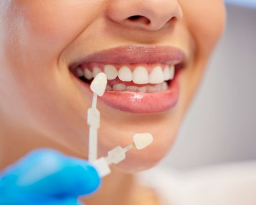 shot-of-an-unrecognisable-woman-having-her-teeth-c-2023-11-27-05-17-20-utc